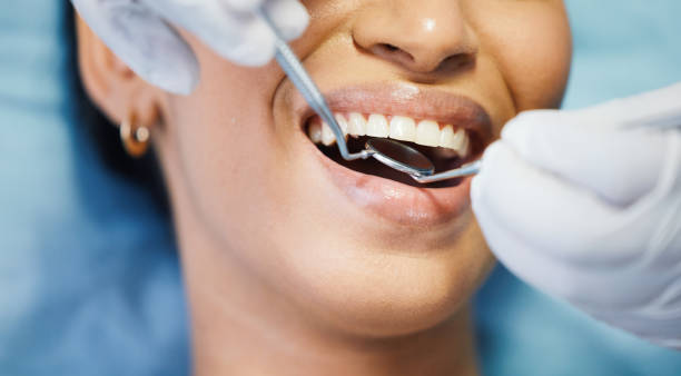 Best Emergency Tooth Extraction in New Bern, NC