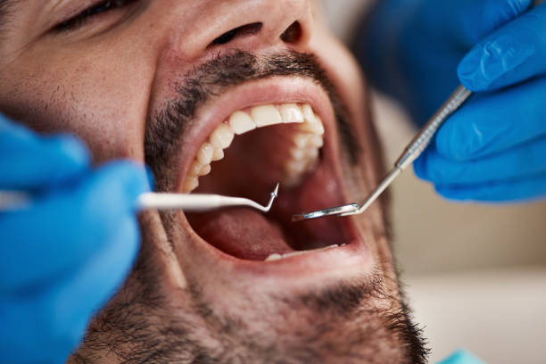 Best Emergency Treatment for Toothache in New Bern, NC